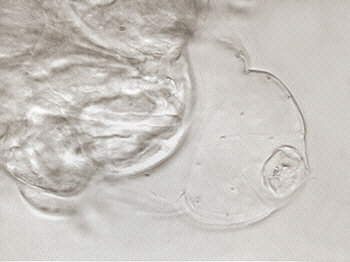 [ Tardigrade (tardigrada) during moulting  ]